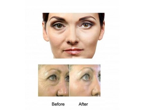 3x Derma roller  Δέρμα ρολλερ για φροντίδα του δέρματος πρόσωπο σώμα μάτια - 4