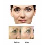 3x Derma roller  Δέρμα ρολλερ για φροντίδα του δέρματος πρόσωπο σώμα μάτια - 4